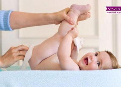 درمان سنتی سوختگی پای نوزاد