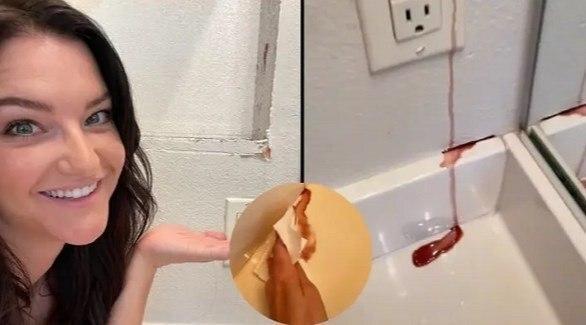 غافلگیری یک زن پس از ورود به حمام و مشاهده خونریزی از دیوار